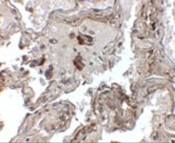 TTR Antibody
