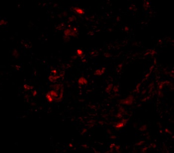 TTR Antibody