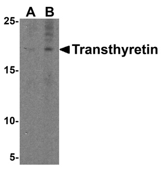 TTR Antibody