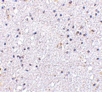 VISA Antibody