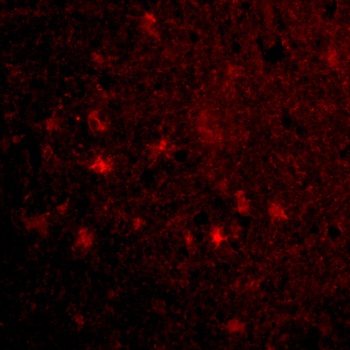 VISA Antibody