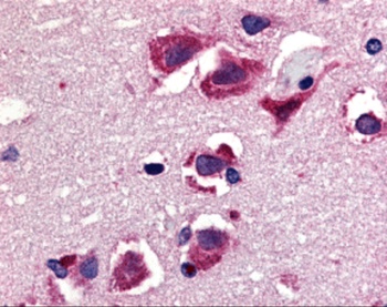 Trail Antibody