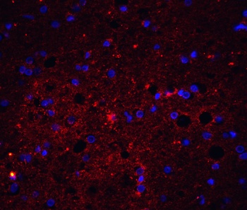 Trail Antibody
