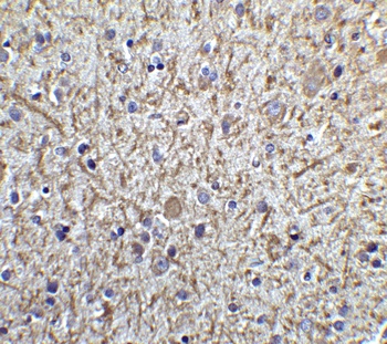 TOLLIP Antibody