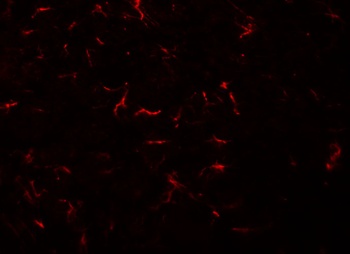 VENTX Antibody