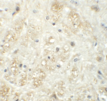 VASH1 Antibody