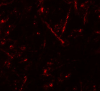 VASH1 Antibody
