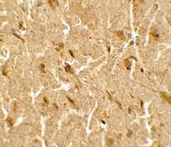 USP25 Antibody