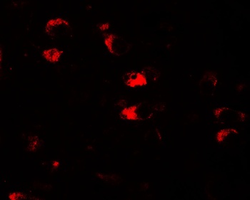 USP25 Antibody