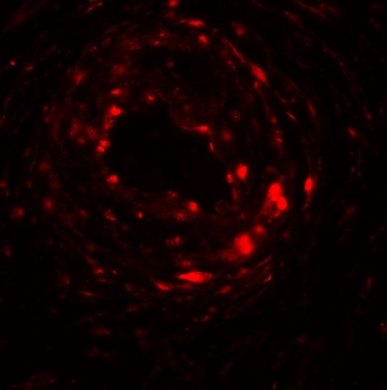 UPK1B Antibody