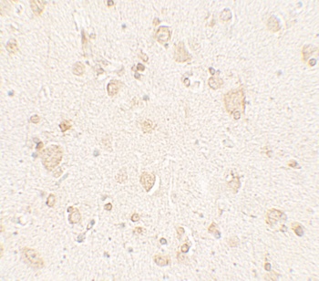 ULK4 Antibody