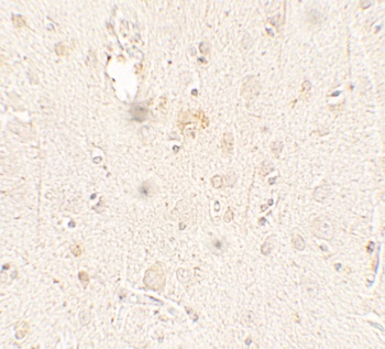 ULK3 Antibody