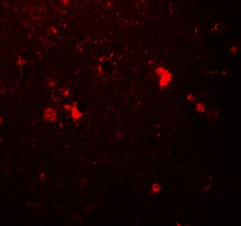 ULK3 Antibody