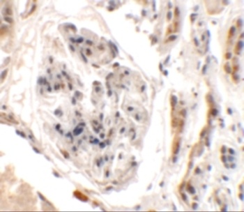 UHRF1BP1L Antibody