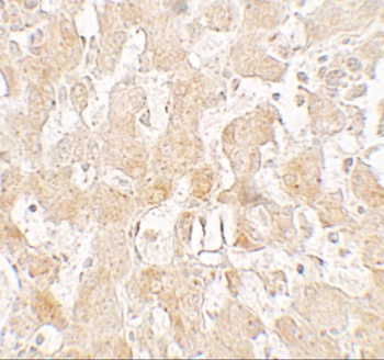 UCP1 Antibody