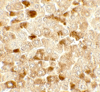 UBIAD1 Antibody