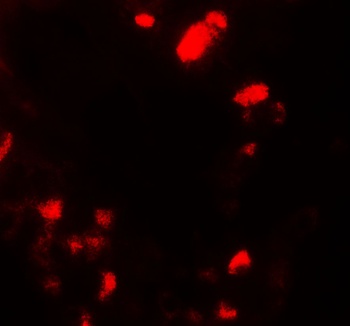 UBIAD1 Antibody