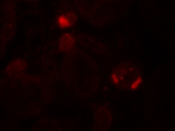 UBD Antibody