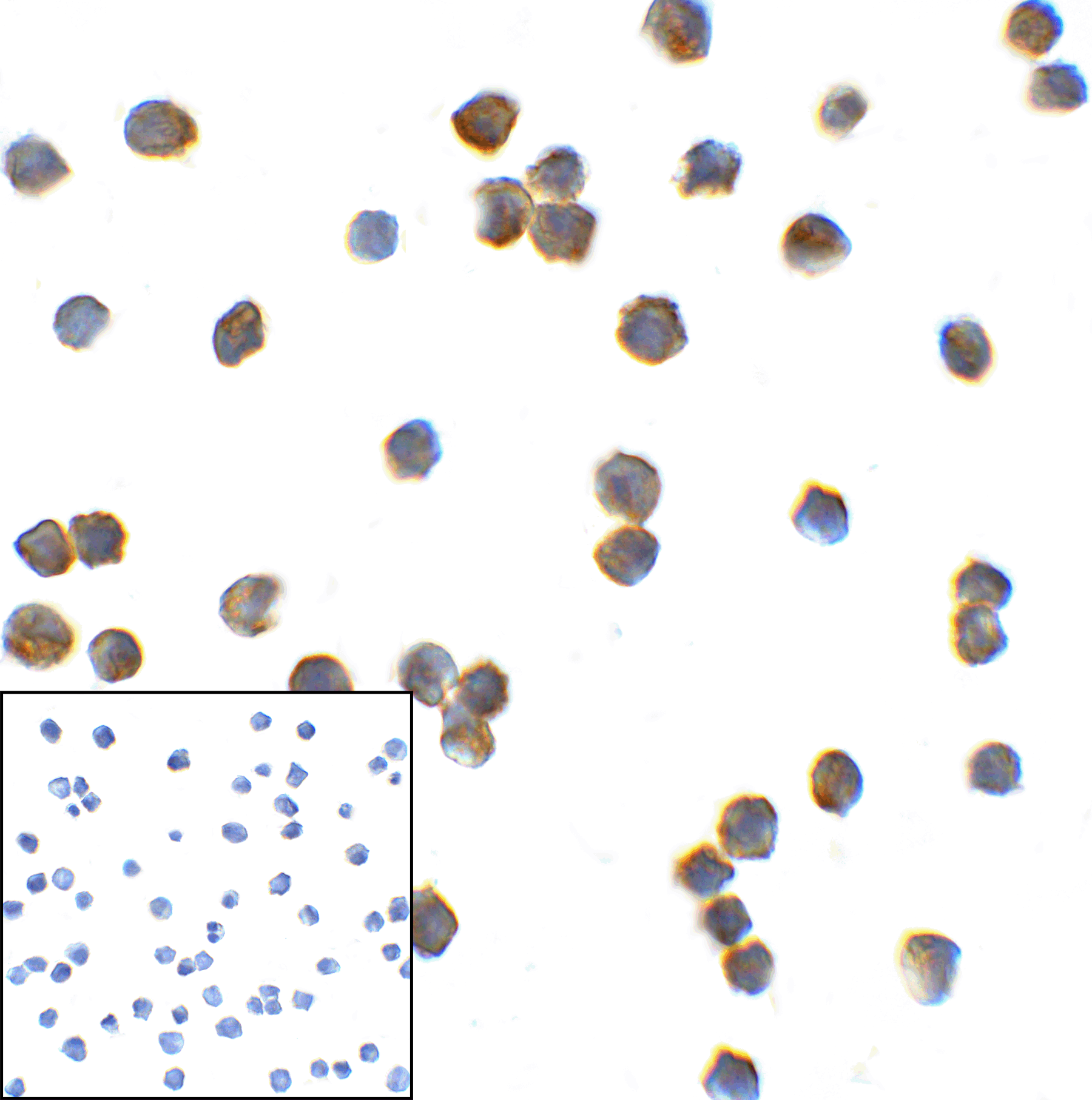 TMIGD2 Antibody