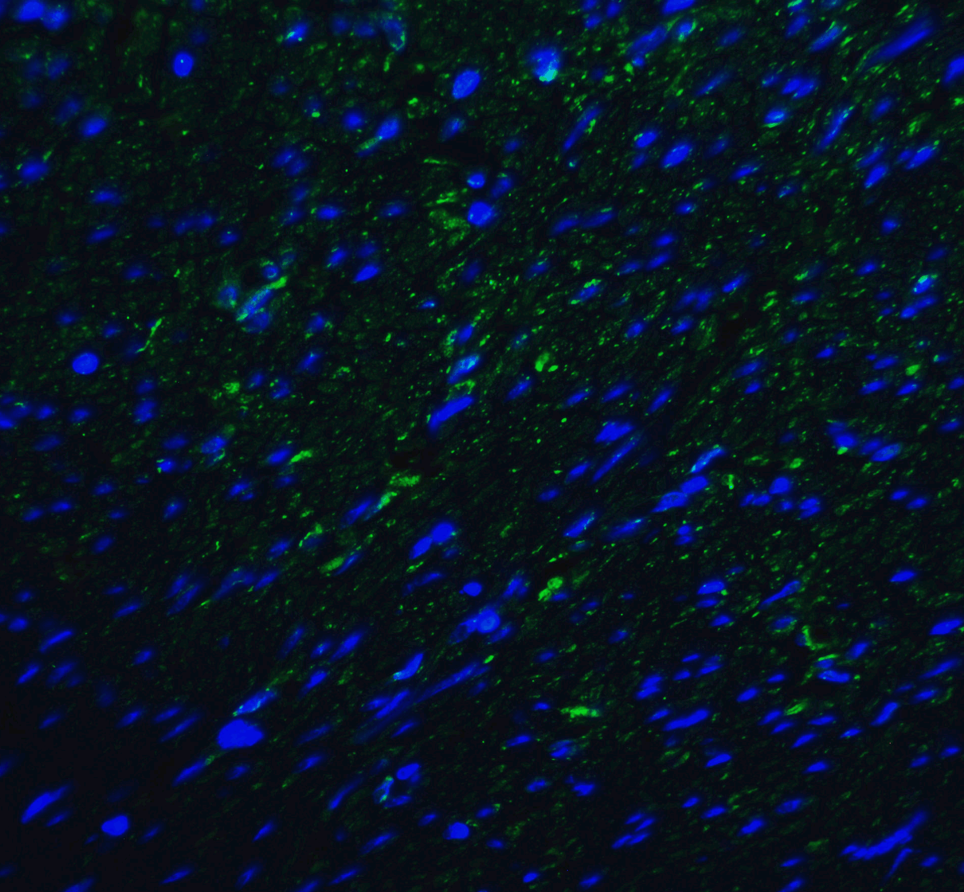 TMIGD2 Antibody [8G1]