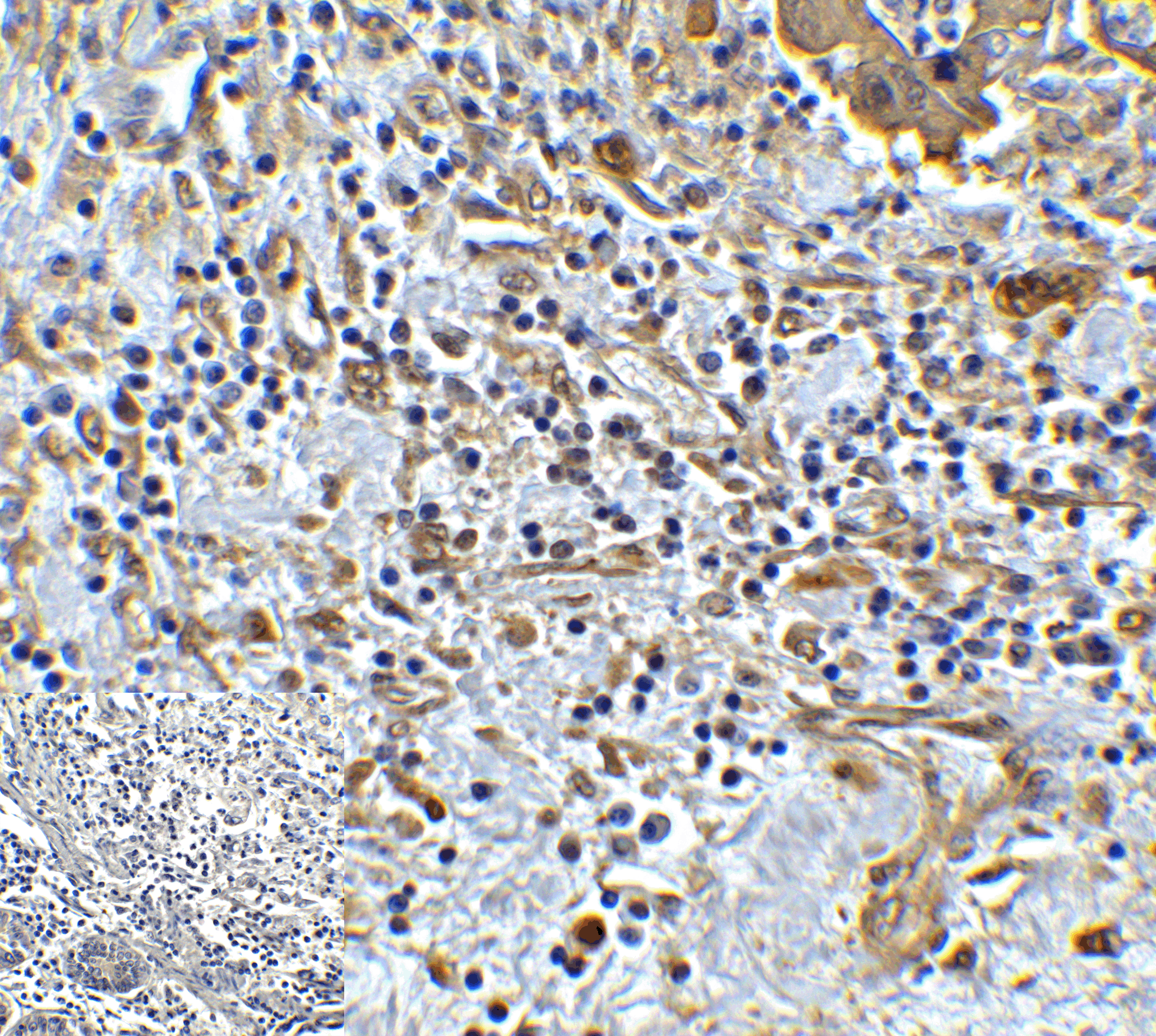 TMIGD2 Antibody