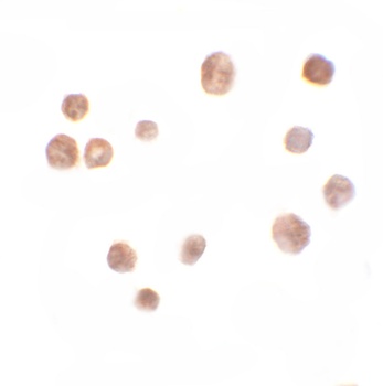 TRMT12 Antibody