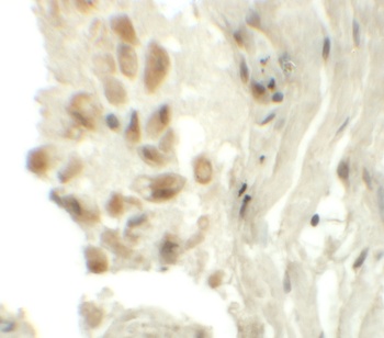 TYW1 Antibody