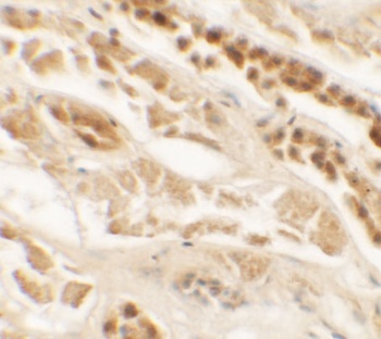 TTYH2 Antibody