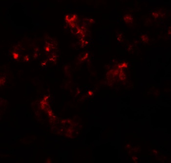 TTYH2 Antibody