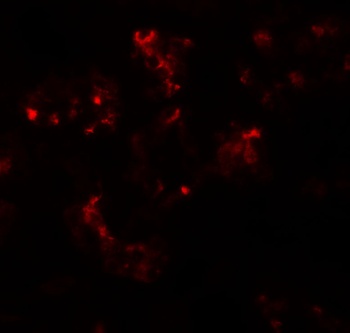 TTYH2 Antibody