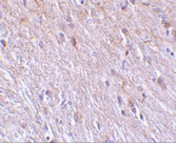 TTC5 Antibody