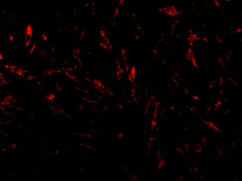 TTC5 Antibody