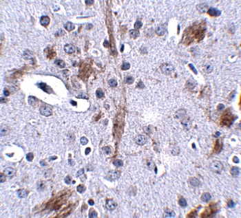 TTBK1 Antibody