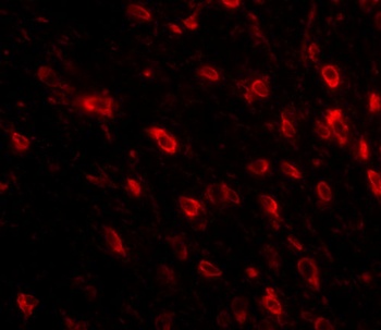 TTBK1 Antibody