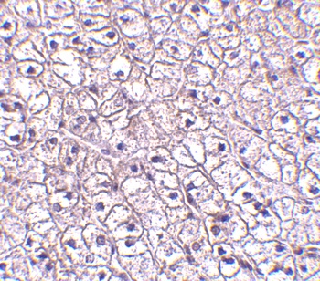 TSLP Receptor Antibody