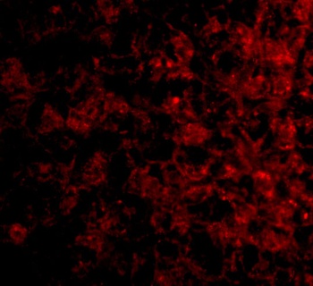 TSLP Receptor Antibody
