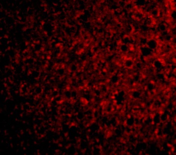TSLP Receptor Antibody