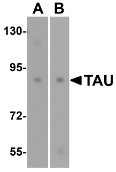 TAU Antibody