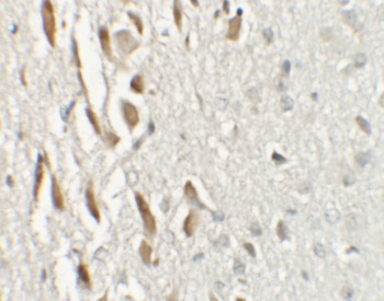 TSHZ3 Antibody