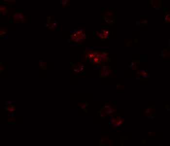 TSHZ2 Antibody