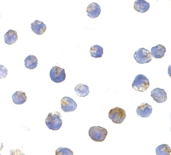 TSC2 Antibody