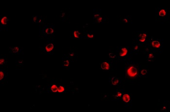 TSC2 Antibody