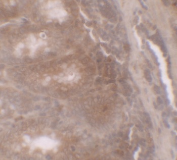 TSC22D3 Antibody