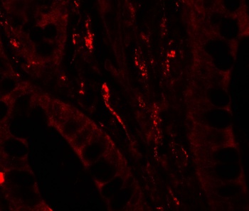 TSC22D3 Antibody