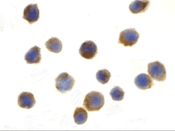 TSC1 Antibody