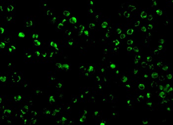 TSC1 Antibody