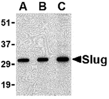 SNAI2 Antibody