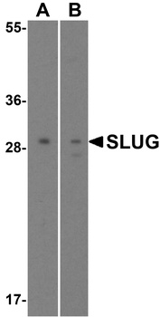 SNAI2 Antibody