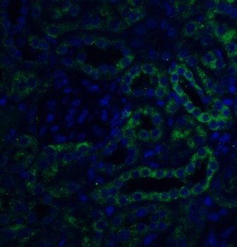 SLC22A17 Antibody