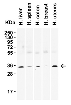 SIGLEC15 Antibody